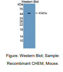 https://msimg.bioon.com/bionline/goods-no-pic.png