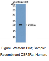 人集落刺激因子2受体α(CSF2Ra)多克隆抗体