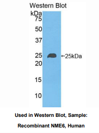人非转移细胞6表达蛋白(NME6)多克隆抗体