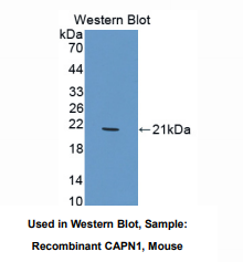 https://msimg.bioon.com/bionline/goods-no-pic.png