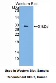 人细胞分裂周期因子7(CDC7)多克隆抗体