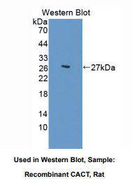 https://msimg.bioon.com/bionline/goods-no-pic.png