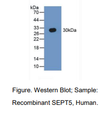 https://msimg.bioon.com/bionline/goods-no-pic.png