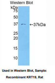 大鼠角蛋白19(CK19)多克隆抗体