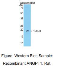 https://msimg.bioon.com/bionline/goods-no-pic.png