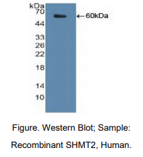 https://msimg.bioon.com/bionline/goods-no-pic.png