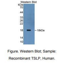 人胸腺基质淋巴细胞生成素(TSLP)多克隆抗体