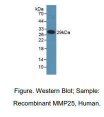 https://msimg.bioon.com/bionline/goods-no-pic.png