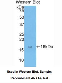 大鼠膜联蛋白A4(ANXA4)多克隆抗体