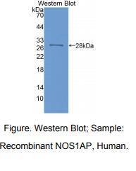 人一氧化氮合酶1衔接蛋白(NOS1AP)多克隆抗体