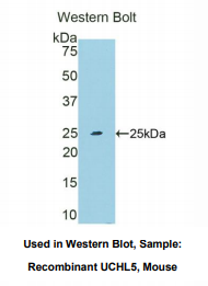 https://msimg.bioon.com/bionline/goods-no-pic.png