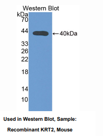 https://msimg.bioon.com/bionline/goods-no-pic.png