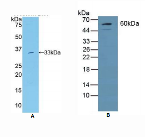 https://msimg.bioon.com/bionline/goods-no-pic.png