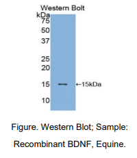 https://msimg.bioon.com/bionline/goods-no-pic.png