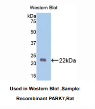 https://msimg.bioon.com/bionline/goods-no-pic.png