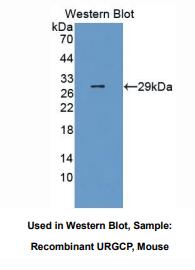 https://msimg.bioon.com/bionline/goods-no-pic.png