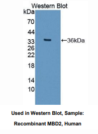 https://msimg.bioon.com/bionline/goods-no-pic.png