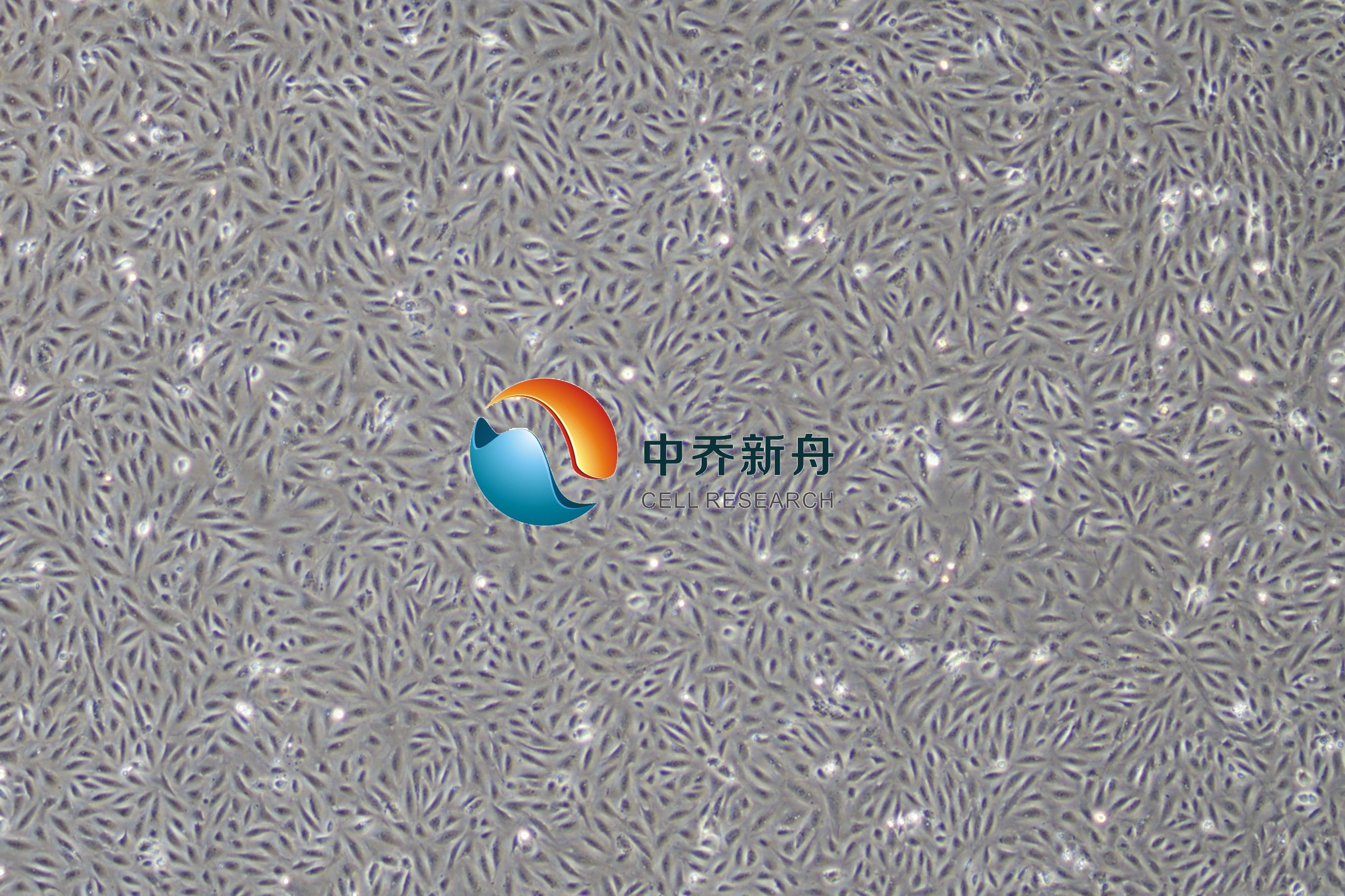 人肾小球内皮细胞永生化
