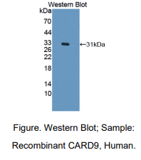 人胱天蛋白酶富集域家族成员9(CARD9)多克隆抗体