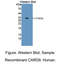 https://msimg.bioon.com/bionline/goods-no-pic.png