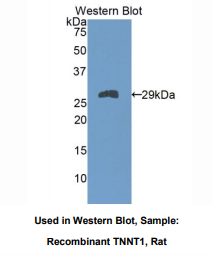 https://msimg.bioon.com/bionline/goods-no-pic.png