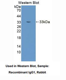 https://msimg.bioon.com/bionline/goods-no-pic.png