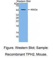 小鼠色氨酸羟化酶2(TPH2)多克隆抗体