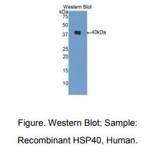 人热休克蛋白40(HSP40)多克隆抗体
