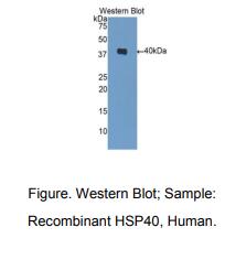 https://msimg.bioon.com/bionline/goods-no-pic.png