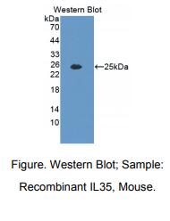 https://msimg.bioon.com/bionline/goods-no-pic.png