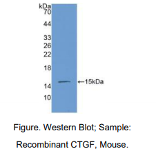 https://msimg.bioon.com/bionline/goods-no-pic.png