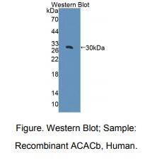 人乙酰辅酶A羧化酶β(ACACb)多克隆抗体