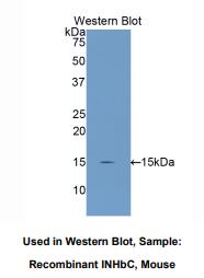 小鼠抑制素βC(INHbC)多克隆抗体