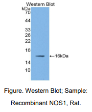 https://msimg.bioon.com/bionline/goods-no-pic.png