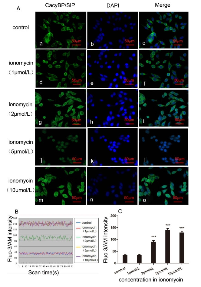 https://img.medsci.cn/e73eefcea40976357f460123cbf1e819c54e5106c9b457225be13b1cbc991aff.png