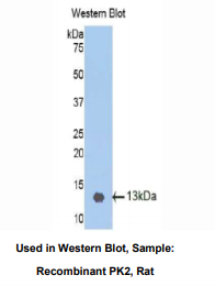 https://msimg.bioon.com/bionline/goods-no-pic.png