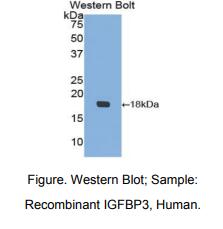 人胰岛素样生长因子结合蛋白3(IGFBP3)多克隆抗体