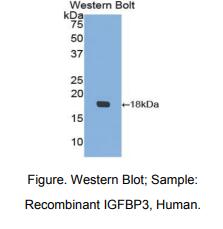 https://msimg.bioon.com/bionline/goods-no-pic.png