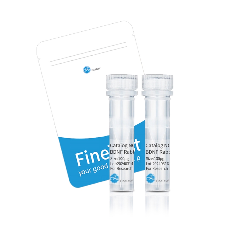ALDOB antibody|ALDOB抗體