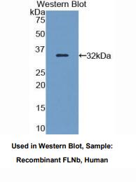 人丝蛋白Bβ(FLNb)多克隆抗体