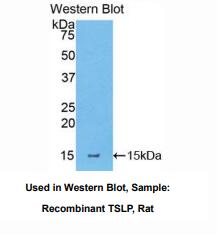 https://msimg.bioon.com/bionline/goods-no-pic.png