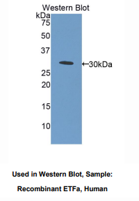 人电子转移黄素蛋白α肽(ETFa)多克隆抗体