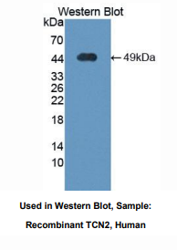 https://msimg.bioon.com/bionline/goods-no-pic.png