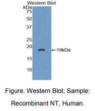 https://msimg.bioon.com/bionline/goods-no-pic.png