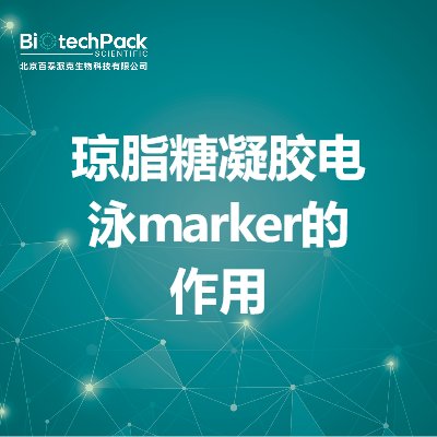 琼脂糖凝胶电泳marker的作用