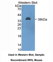 https://msimg.bioon.com/bionline/goods-no-pic.png