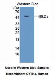 人细胞附着蛋白4(CYTH4)多克隆抗体