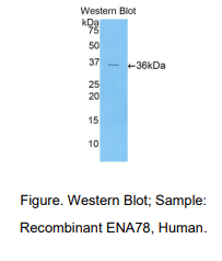 https://msimg.bioon.com/bionline/goods-no-pic.png