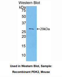 https://msimg.bioon.com/bionline/goods-no-pic.png