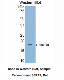 https://msimg.bioon.com/bionline/goods-no-pic.png